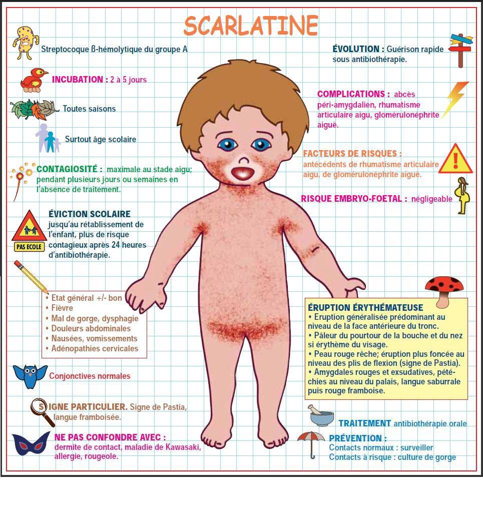 scarlatine-symptomes